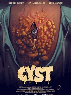 囊肿 CYST (2020)